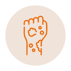 Manchas o<br> cambios de color