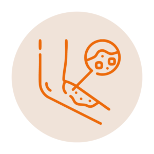 Enrojecimiento<br>&nbsp;